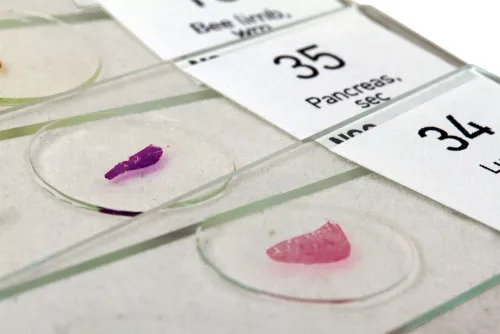 picture Levenhuk N80 NG "See it all" Slides Set,  6